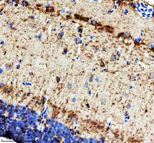  IHC analysis of ILK using anti-ILK antibody (AZQ6PHD6-2)