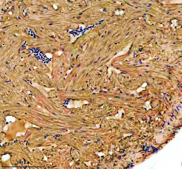 IHC analysis of ILK using anti-ILK antibody (AZQ6PHD6-2)