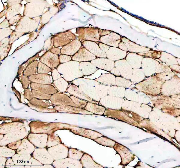azq6phd6 2 ilk primary antibodies ihc testing 4