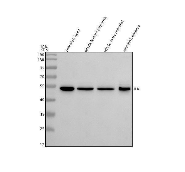  Western blot analysis of ILK using anti-ILK antibody (AZQ6PHD6-2)