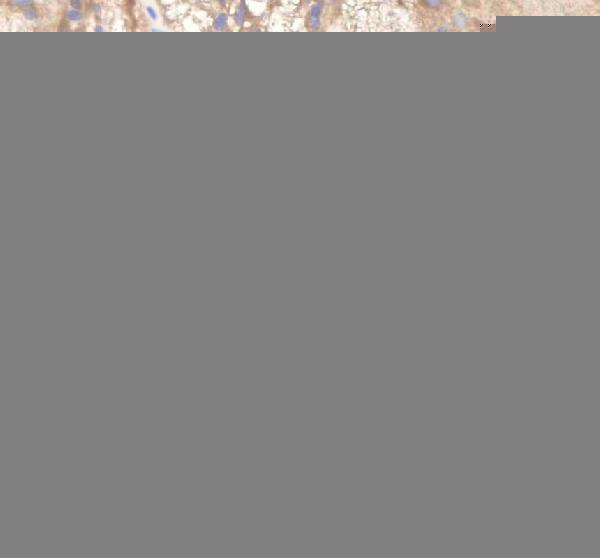 azq6phh3 pdcd10a b primary antibodies ihc testing 1