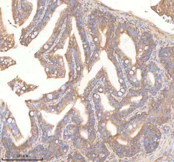 azq6phh3 pdcd10a b primary antibodies ihc testing 2