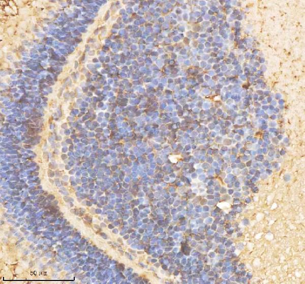 azq6phk7 psmd2 primary antibodies ihc testing 1