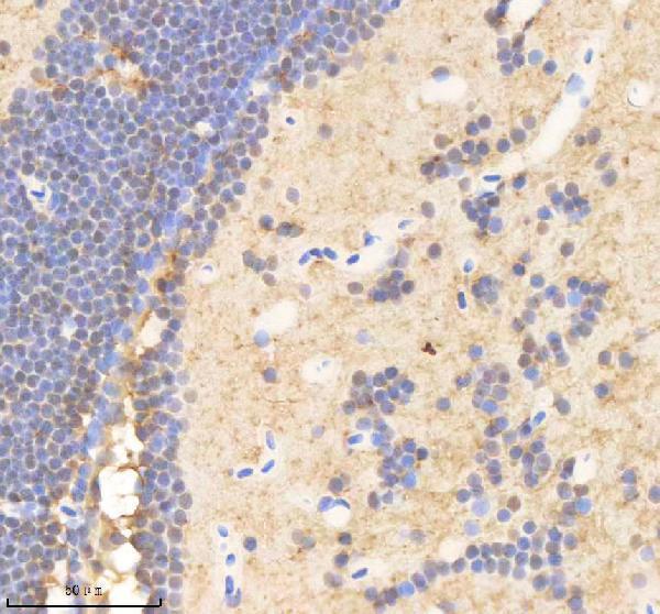 azq6phk7 psmd2 primary antibodies ihc testing 2