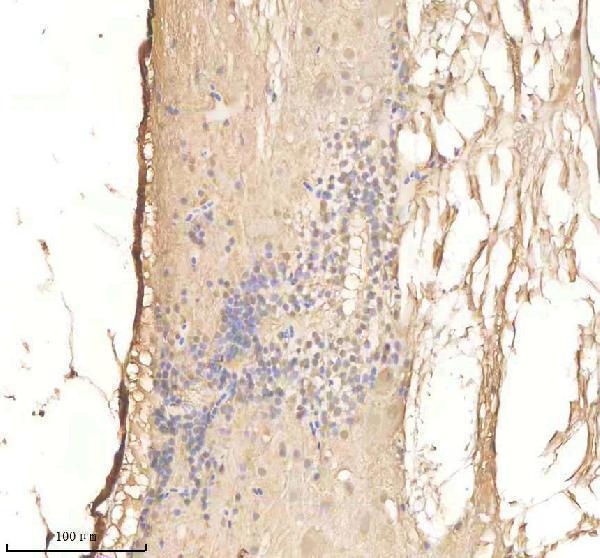 azq6phk7 psmd2 primary antibodies ihc testing 3