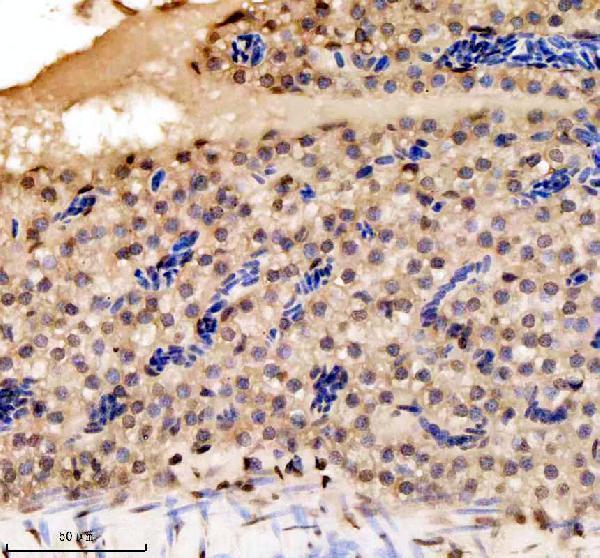 azq6pi20 histone h3 primary antibodies ihc testing 4