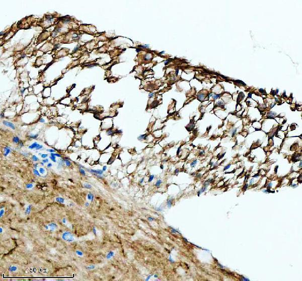 IHC analysis of LHB using anti-LHB antibody (AZQ6TCF5)