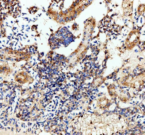 azq6tcf5 lhb primary antibodies ihc testing 5