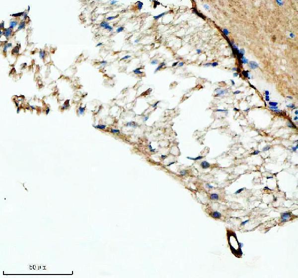 IHC analysis of FSHB using anti-FSHB antibody (AZQ6TCF7)