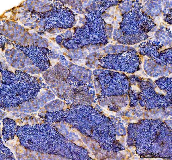 azq6tcf7 fshb primary antibodies ihc testing 3