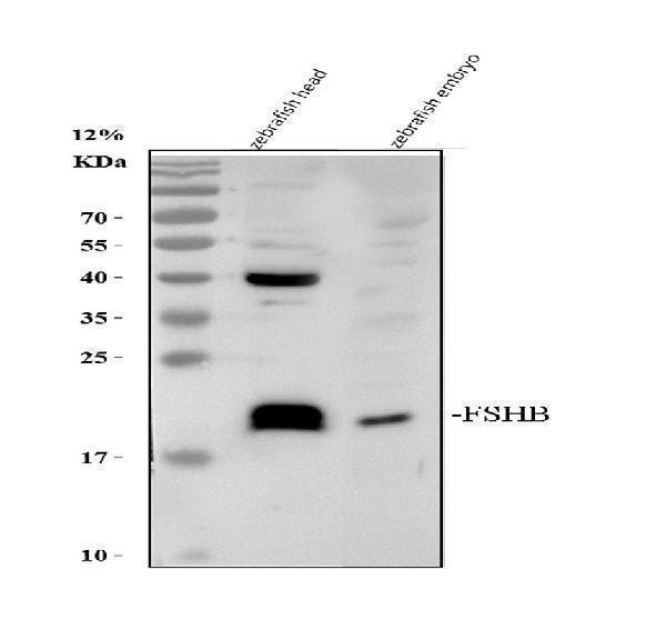 Western blot analysis of FSHB using anti-FSHB antibody (AZQ6TCF7)