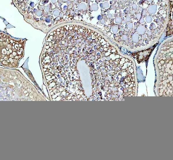 IHC analysis of LHCGR using anti-LHCGR antibody (AZQ6TCF8)