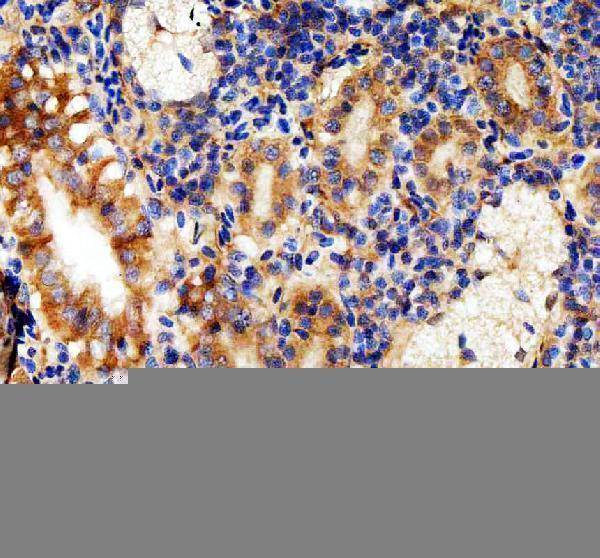 IHC analysis of LHCGR using anti-LHCGR antibody (AZQ6TCF8)