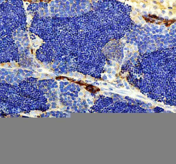 IHC analysis of LHCGR using anti-LHCGR antibody (AZQ6TCF8)