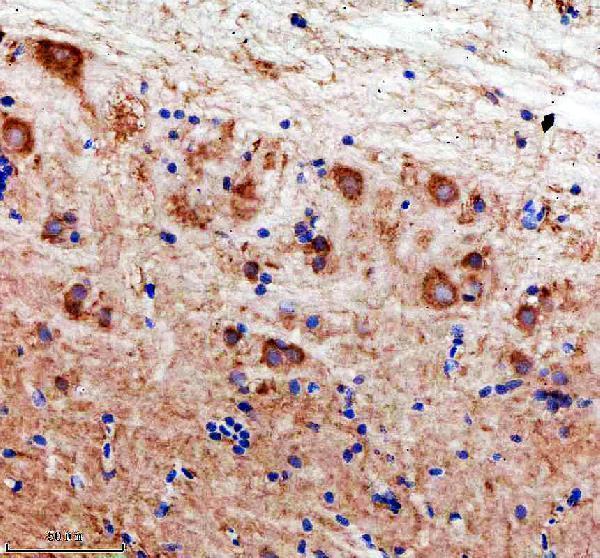 azq6tcf8 lhcgr primary antibodies ihc testing 4