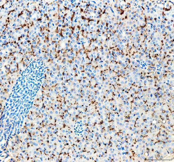 azq6tcf8 lhcgr primary antibodies ihc testing 5