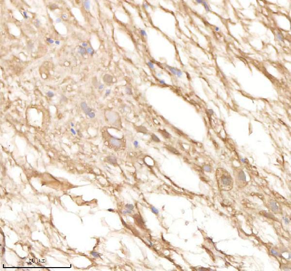 IHC analysis of PSMA5 using anti-PSMA5 antibody (AZQ6TGV6)