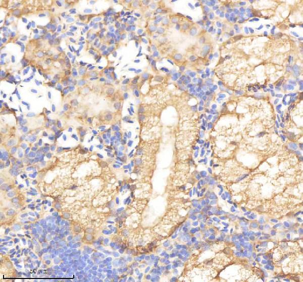 IHC analysis of PSMA5 using anti-PSMA5 antibody (AZQ6TGV6)
