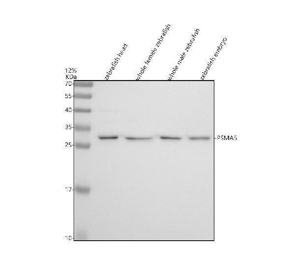 Western blot analysis of PSMA5 using anti-PSMA5 antibody (AZQ6TGV6)