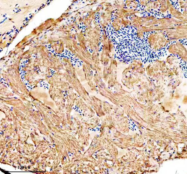 IHC analysis of OSTF1 using anti-OSTF1 antibody (AZQ6TGW5)
