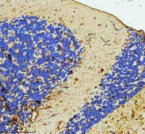  IHC analysis of C9orf72 using anti-C9orf72 antibody (AZQ6TLH8)
