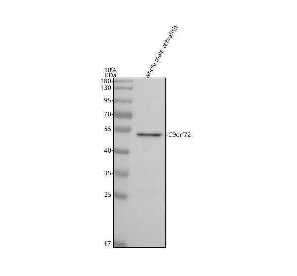  Western blot analysis of C9orf72 using anti-C9orf72 antibody (AZQ6TLH8)