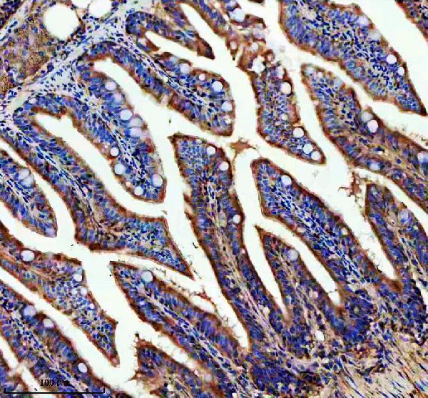 azq6tnw3 1 abce1 primary antibodies ihc testing 3