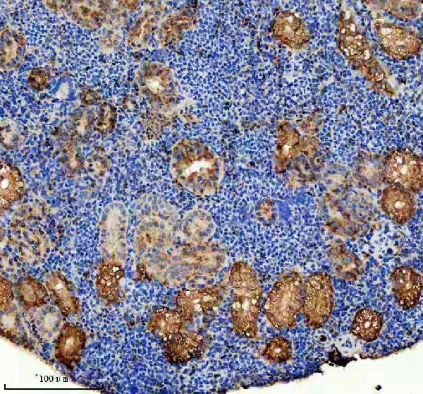 azq6tnw3 1 abce1 primary antibodies ihc testing 4