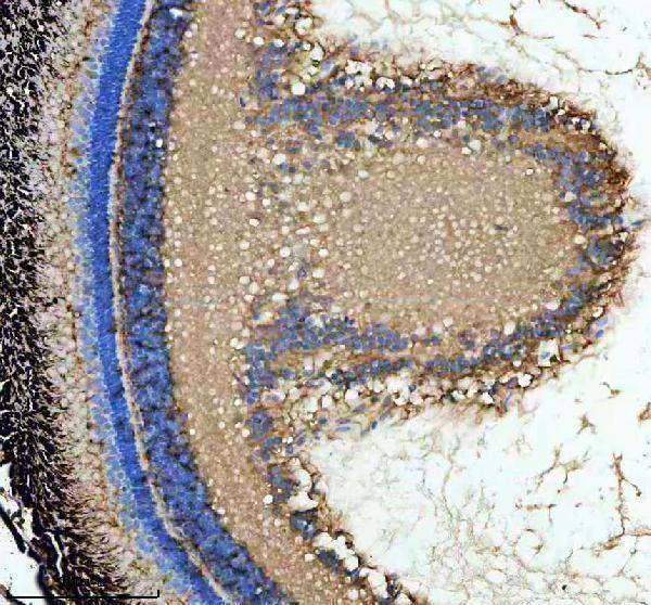 azq6tnw3 1 abce1 primary antibodies ihc testing 5