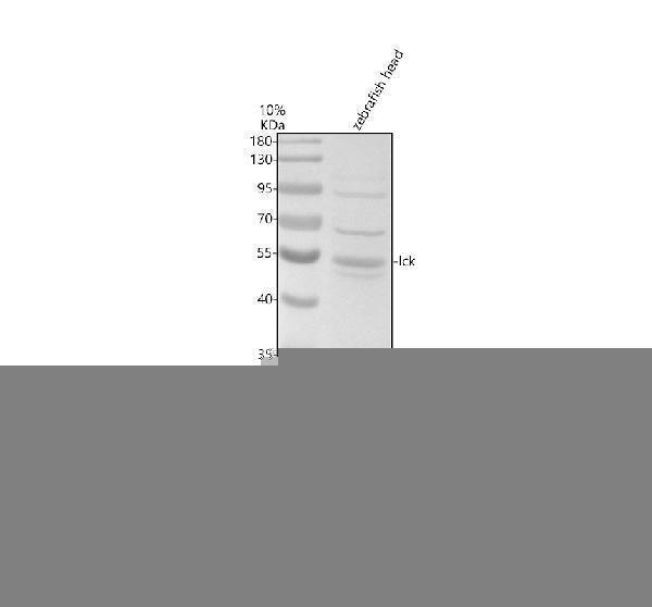 Western blot analysis of LCK using anti-LCK antibody (AZQ6TPQ4)