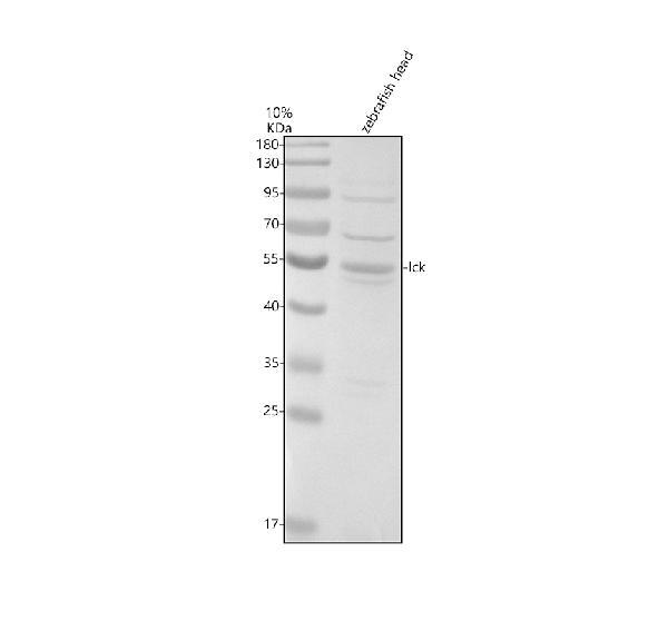Western blot analysis of LCK using anti-LCK antibody (AZQ6TPQ4)