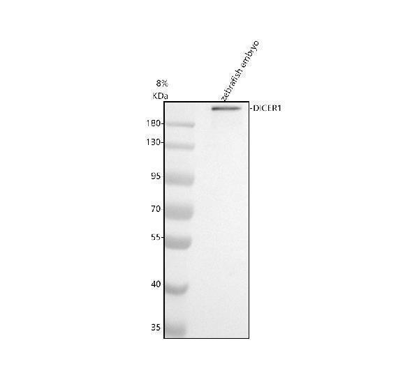  Western blot analysis of DICER1 using anti-DICER1 antibody (AZQ6TV19)