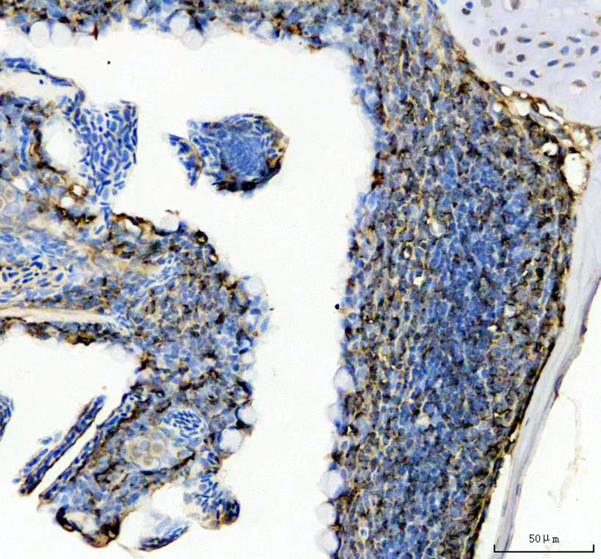 azq7sx58 coro1a primary antibodies ihc testing 1