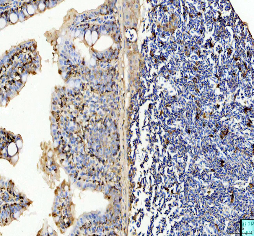 azq7sx58 coro1a primary antibodies ihc testing 2