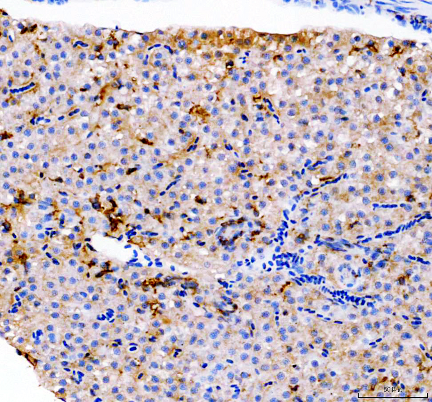azq7sx58 coro1a primary antibodies ihc testing 3