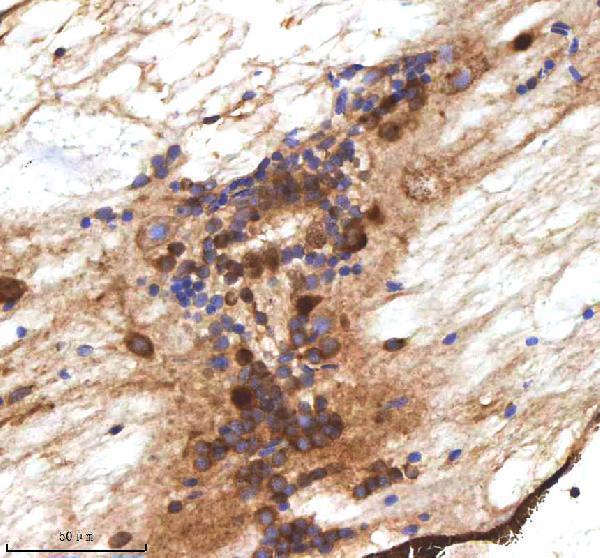  IHC analysis of MPEG1 using anti-MPEG1 antibody (AZQ7SXE0)