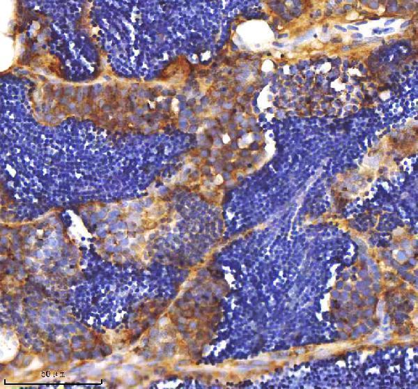  IHC analysis of MPEG1 using anti-MPEG1 antibody (AZQ7SXE0)