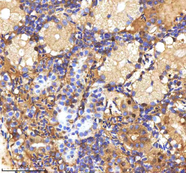 azq7sxe0 mpeg1 primary antibodies ihc testing 5