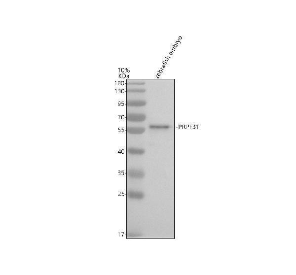 Western blot analysis of PRPF31 using anti-PRPF31 antibody (AZQ7SXM7)