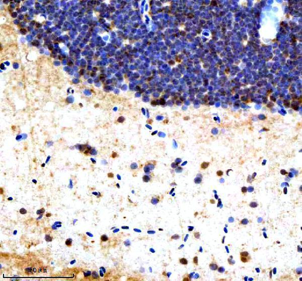 azq7sxp4 srsf1a b primary antibodies ihc testing 1