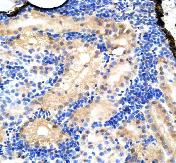 azq7sxp4 srsf1a b primary antibodies ihc testing 3
