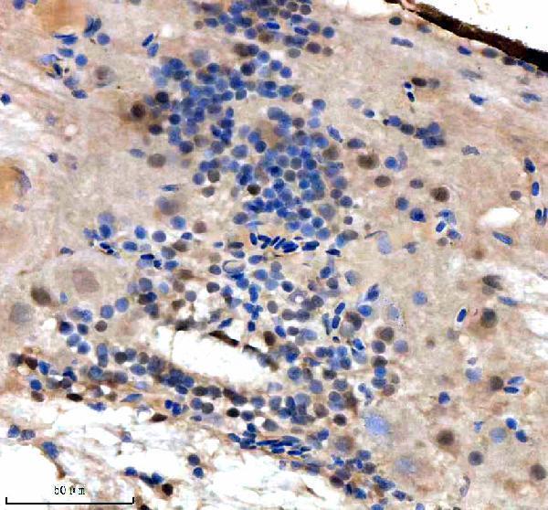 azq7sxp4 srsf1a b primary antibodies ihc testing 4