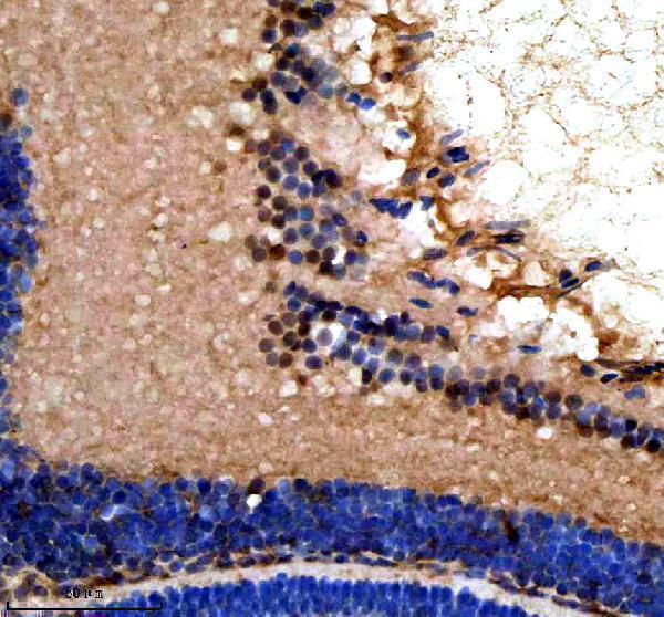 azq7sxp4 srsf1a b primary antibodies ihc testing 5