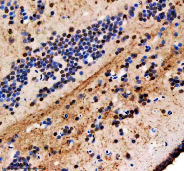 azq7sxq3 hnrnpa1a b primary antibodies ihc testing 1