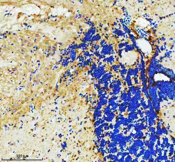  IHC analysis of ARP2/ACTR2 using anti-ARP2/ACTR2 antibody (AZQ7SXW6)