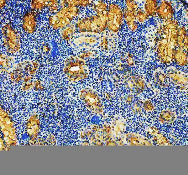  IHC analysis of ARP2/ACTR2 using anti-ARP2/ACTR2 antibody (AZQ7SXW6)