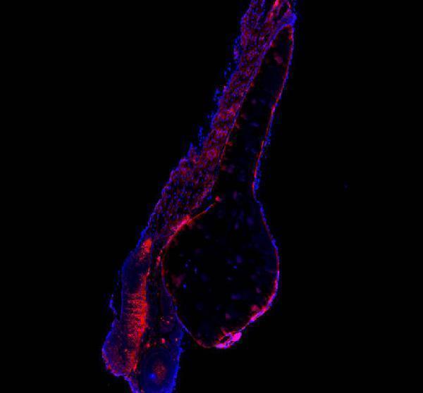  IF analysis of ATP6V1A using anti-ATP6V1A antibody (AZQ7SY46)