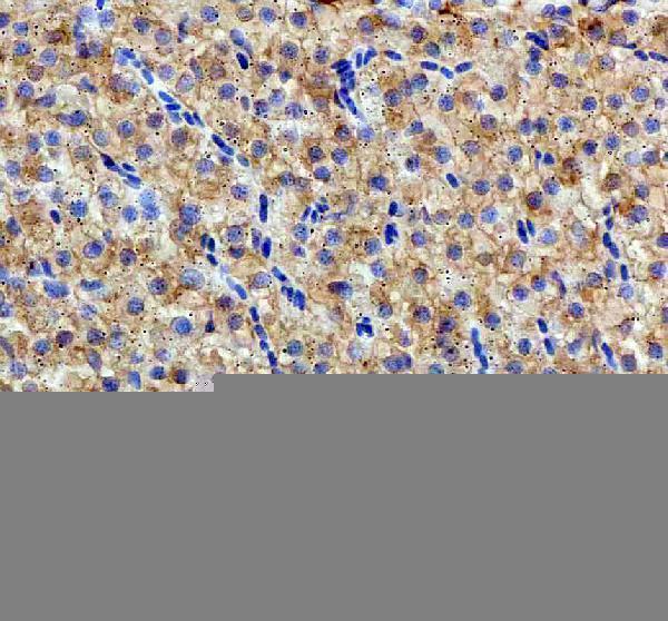 IHC analysis of HSPA5 using anti-HSPA5 antibody (AZQ7SZD3)