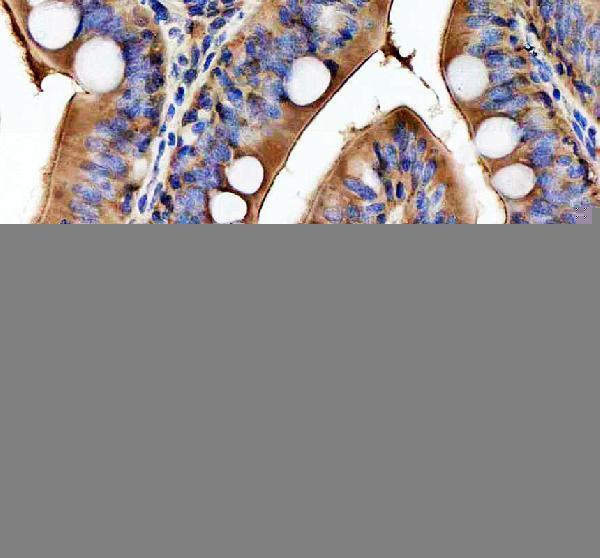 IHC analysis of HSPA5 using anti-HSPA5 antibody (AZQ7SZD3)
