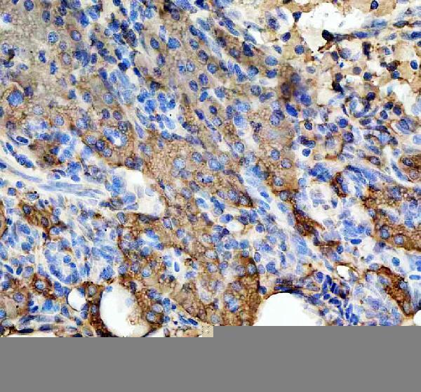 azq7szd3 hspa5 primary antibodies ihc testing 3